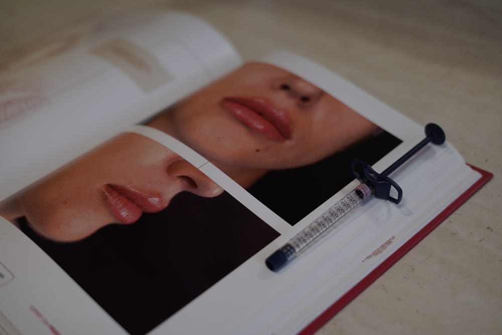 Seringa de preenchimento sobre livro de harmonização labial no consultório